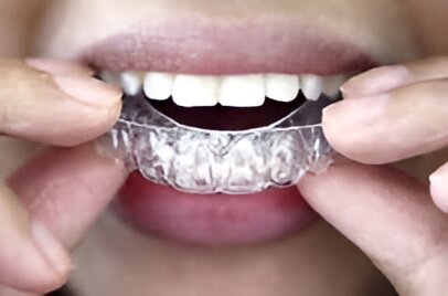 Satisfied dental patient showing her beautiful smile Satisfied dental patient showing her beautiful smile